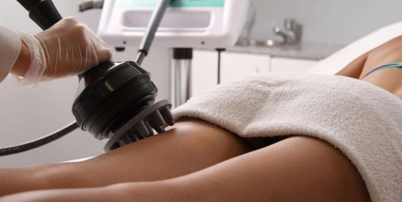 Samsun Lazer Epilasyon Samsun Lazer Epilasyon